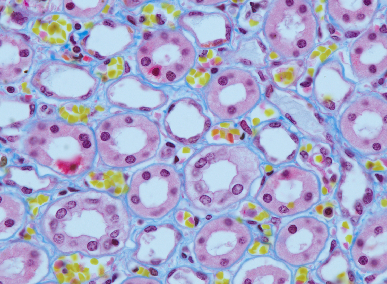 人类纤维蛋白肾。三色染色。物镜：蔡司Plan-Apochromat 63× / 1.4油镜 