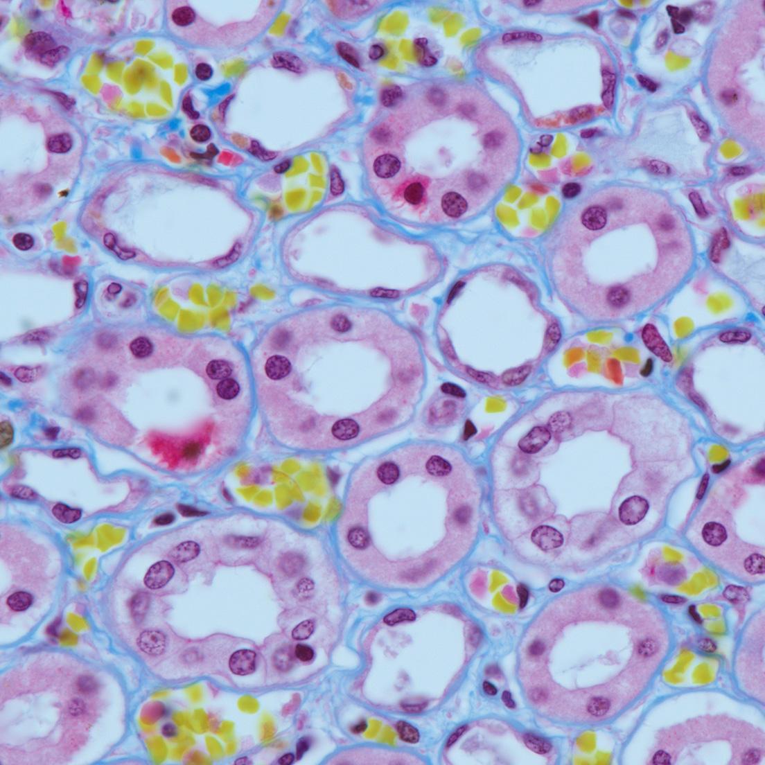 Human fibrin kidney. Trichrome staining. Objective: ZEISS Plan-Apochromat 63x/1.4 oil