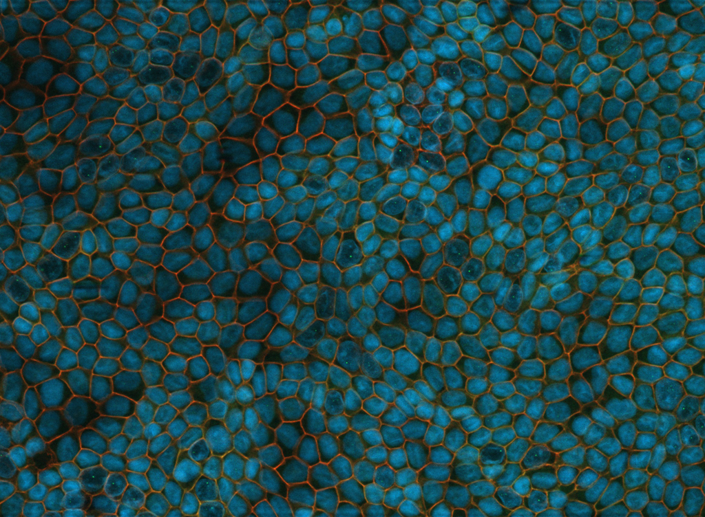 Polarized CACO-2 cells. Filter-grown for two weeks. Specimen courtesy of C. Hartmann and K. Ebnet, Center for Molecular Biology of Inflammation, Institute of Medical Biochemistry, WWU Münster, Germany. Specimen courtesy of C. Hartmann and K. Ebnet, Center for Molecular Biology of Inflammation, Institute of Medical Biochemistry, WWU Münster, Germany.