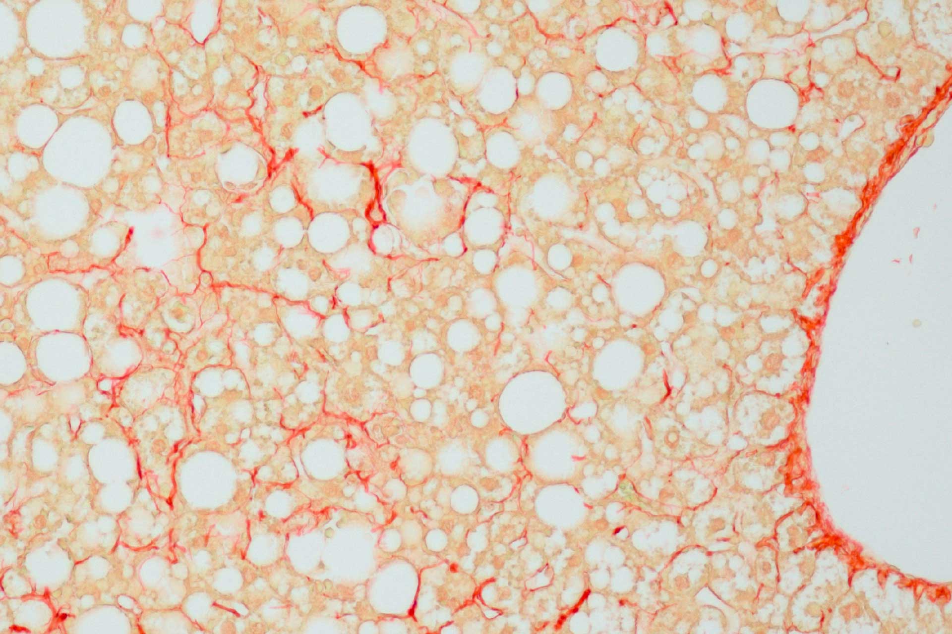 Hígado de ratón con tejido conectivo colagenoso