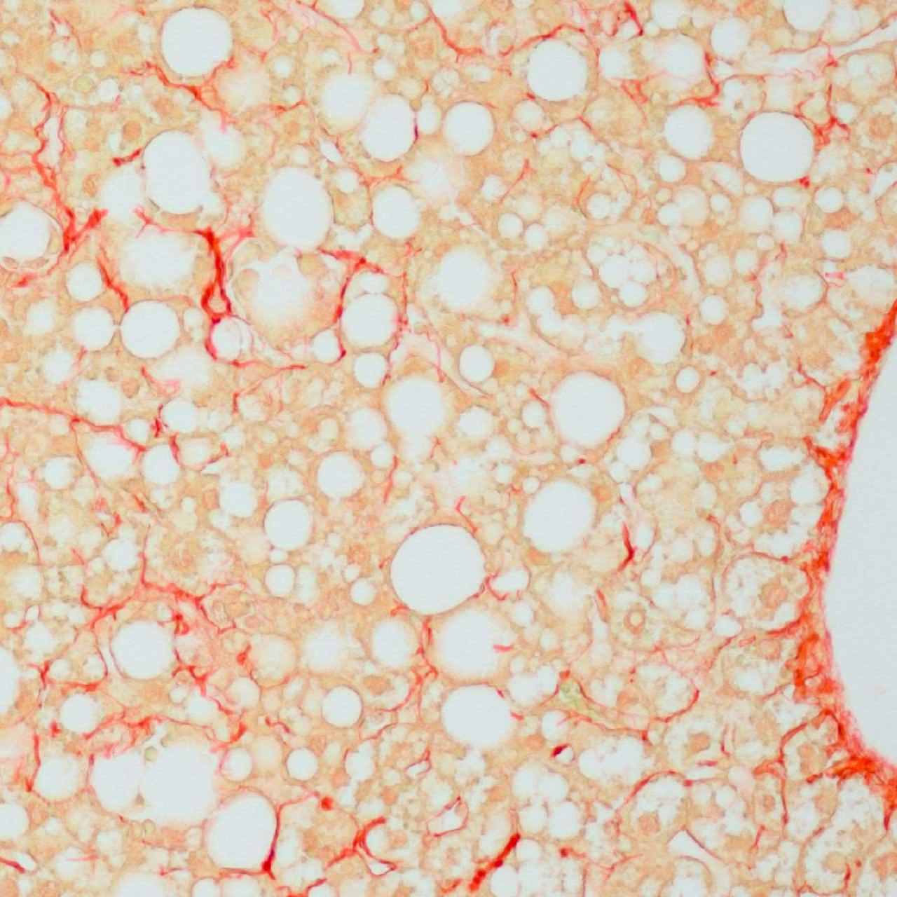 Hígado de ratón con tejido conectivo colagenoso
