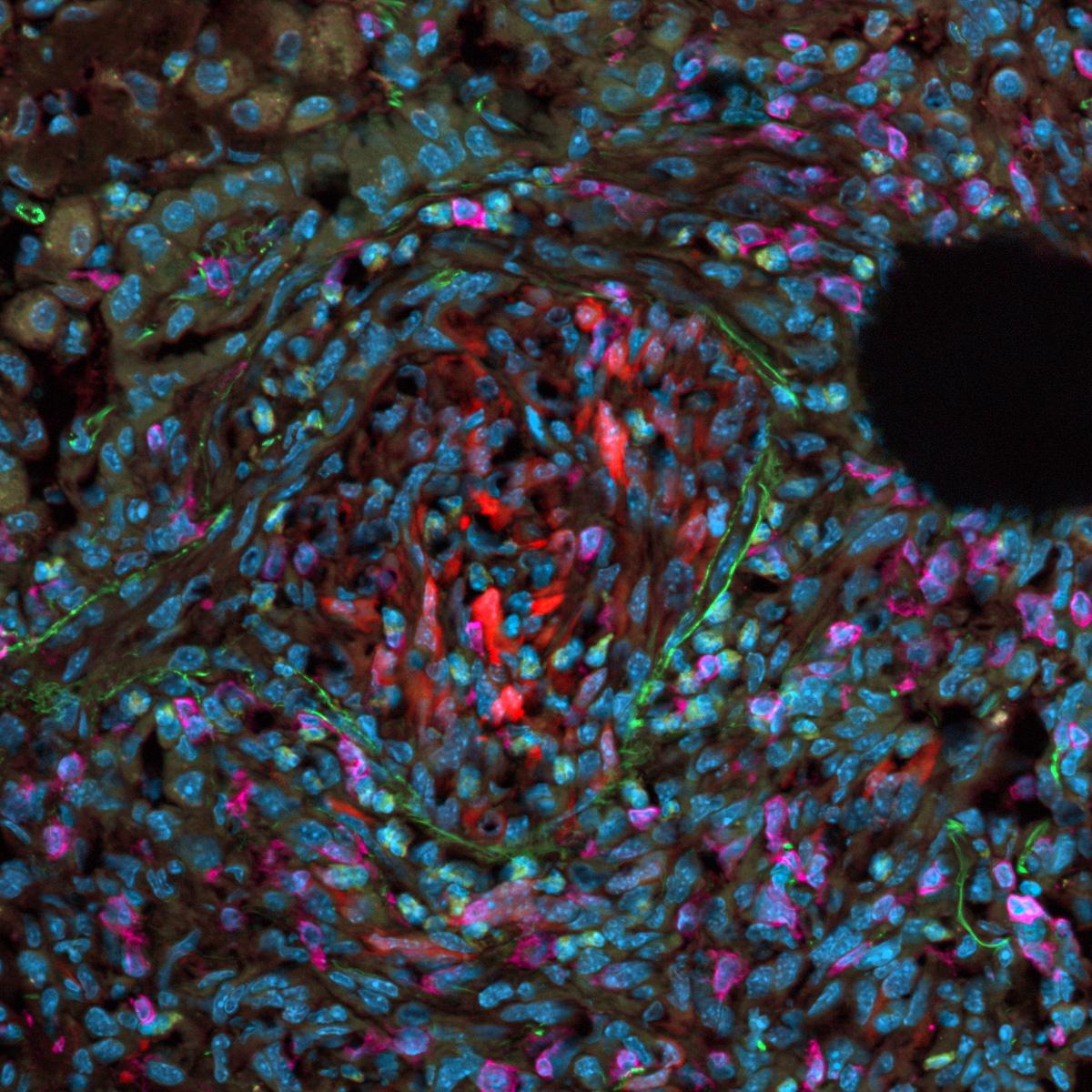 Murines Lungengewebe. Probe mit freundlicher Genehmigung von: H. Ishikawa-Ankerhold, Walter-Brendel-Zentrum für Experimentelle Medizin München, Deutschland