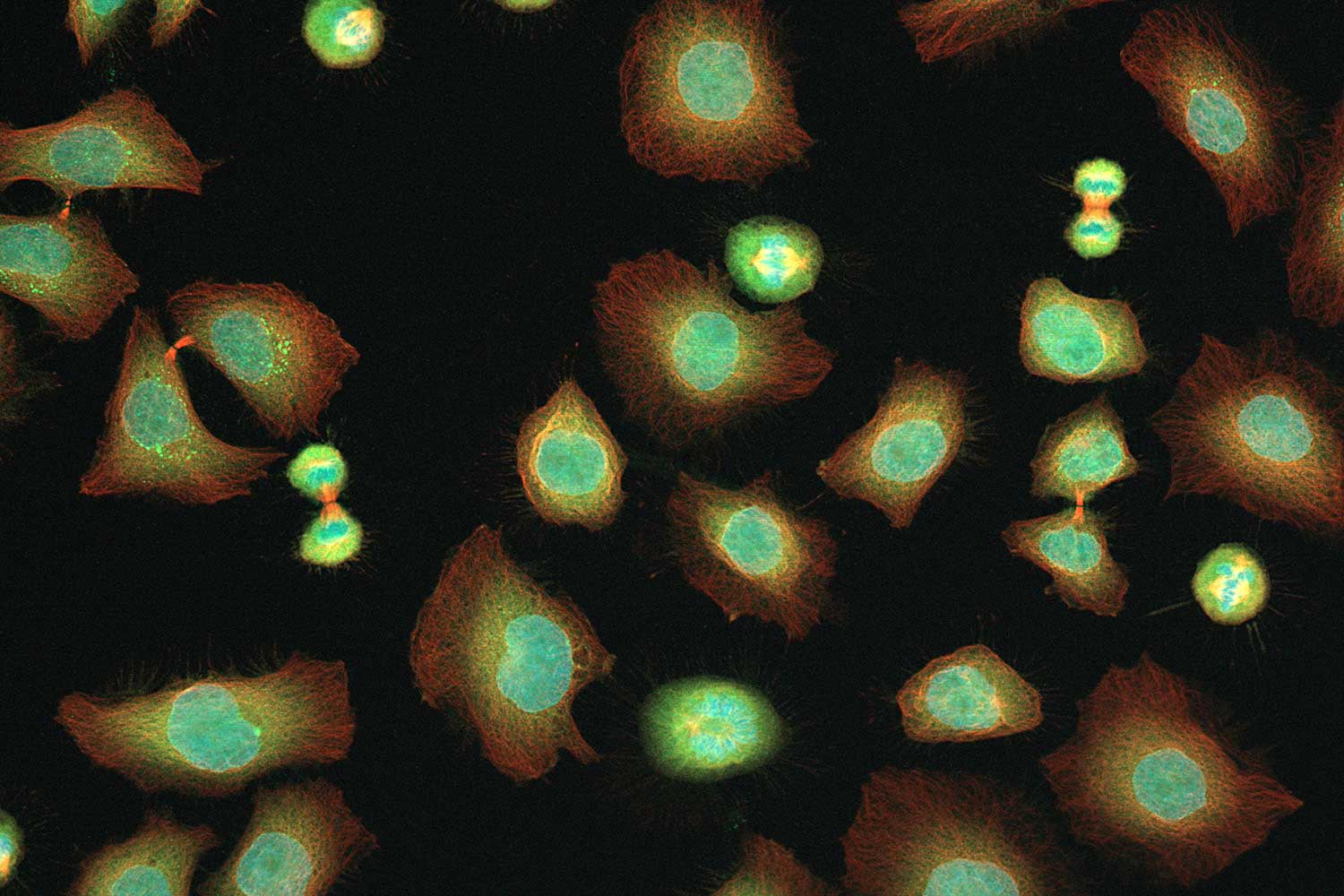 Optischer Schnitt von Zellen in der Mitose, erstellt mit ZEISS Apotome