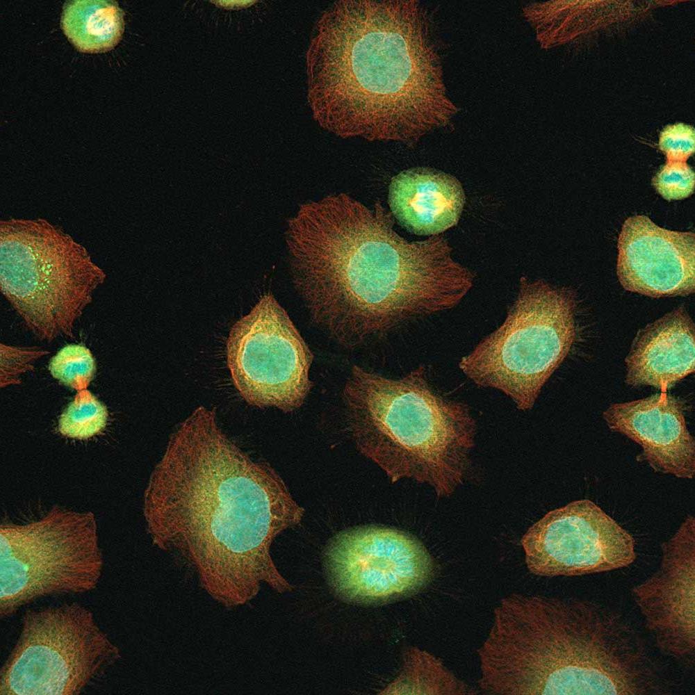 Optical section of mitotic cells created with ZEISS Apotome.