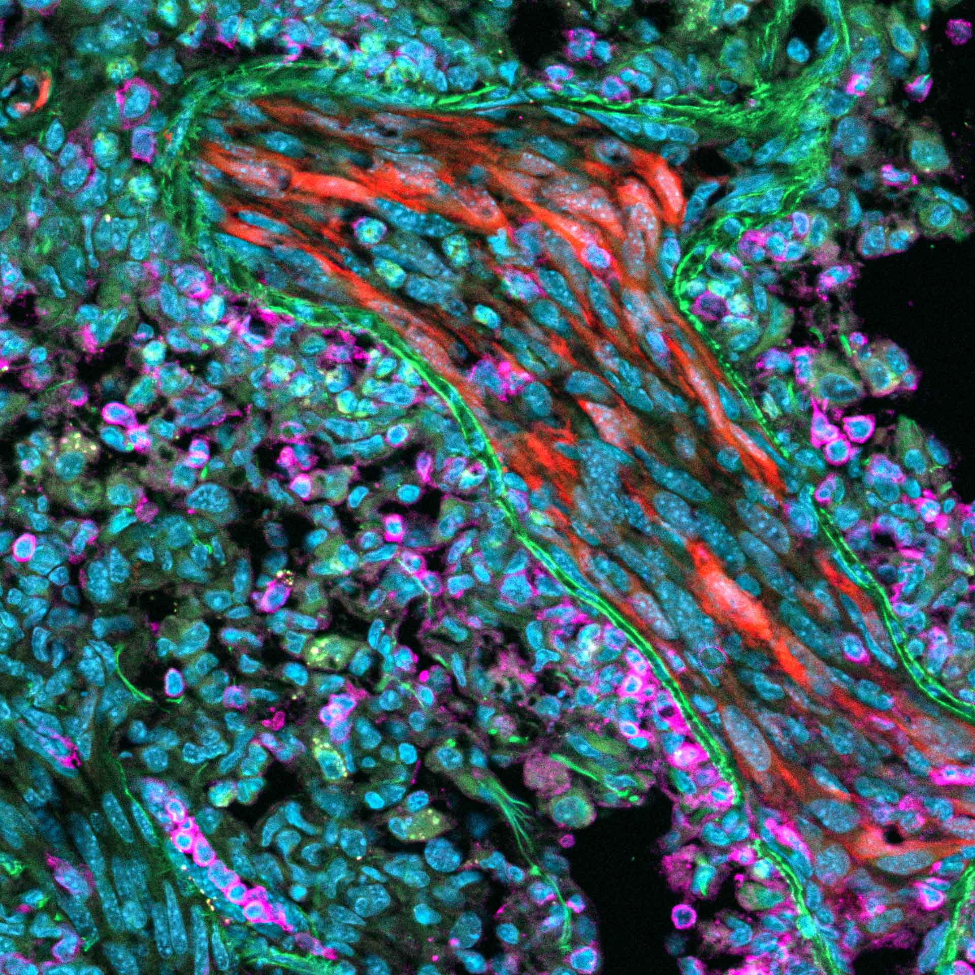 Murine lung tissue. Sample courtesy of A. Feuchtinger, Helmholtz Zentrum München, Germany