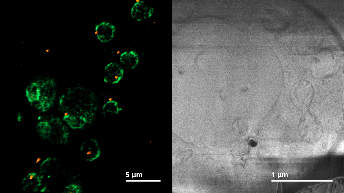 Doppelt markierte Hefezellen (CNM67-tdTomato und NUP-GFP). LSM-Bild (links) und Crossbeam-Bild (rechts).  M. Pilhofer, ETH Zürich, Schweiz