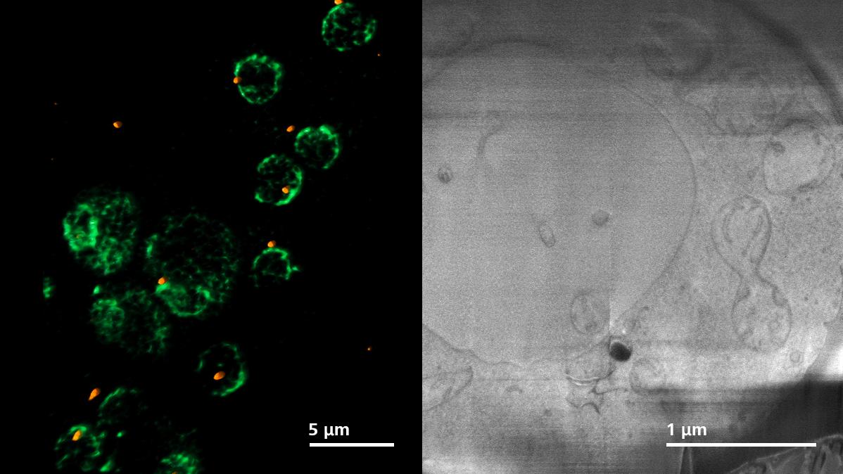 Doppelt markierte Hefezellen (CNM67-tdTomato und NUP-GFP). LSM-Bild (links) und Crossbeam-Bild (rechts). 