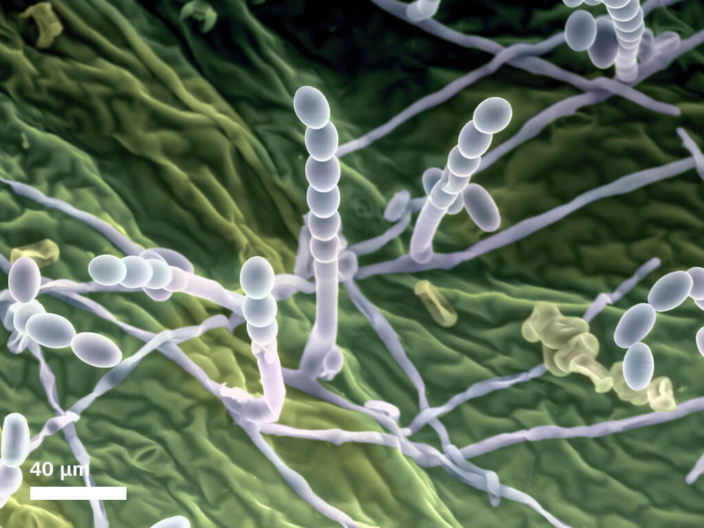 Image en fausses couleurs du mildiou à la surface d'une feuille. Image capturée par un détecteur C2DX à 570 Pa, vapeur d'eau à 1 °C, 20 kV.