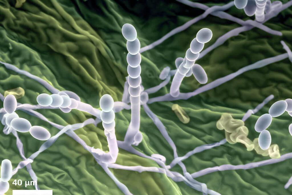 Image en fausses couleurs du mildiou à la surface d'une feuille. Image capturée par un détecteur C2DX à 570 Pa, vapeur d'eau à 1 °C, 20 kV.