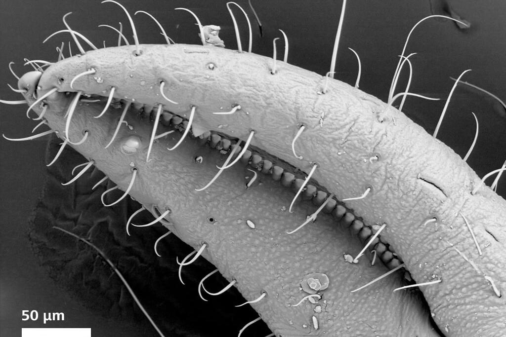 Détail d'un pseudoscorpion, image capturée avec le détecteur BSE sous vide poussé à 20 kV.