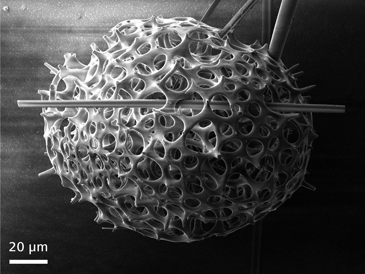 コーティングされていない放散虫（Radiolaria alga）。1 keVの入射電圧でイメージング。ビーム減速なしのイメージングで認められた電荷アーチファクト。