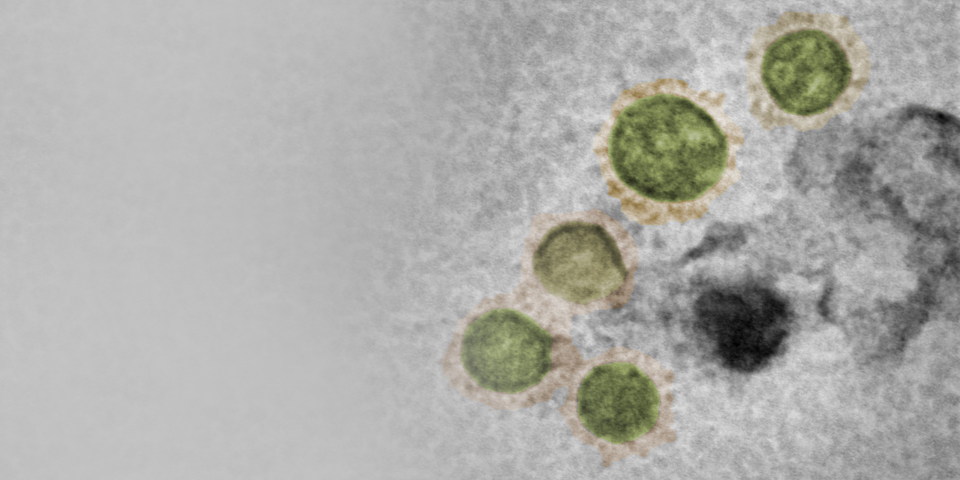 SARS-CoV-2ウイルス、培養、不活化、陰性染色、GeminiSEM 560、aSTEM、HAADF/BF。試料ご提供：M. Hannah, Public Health England, United Kingdom