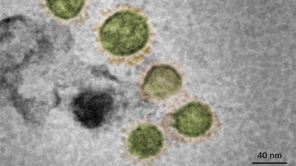 SARS-CoV-2ウイルス
