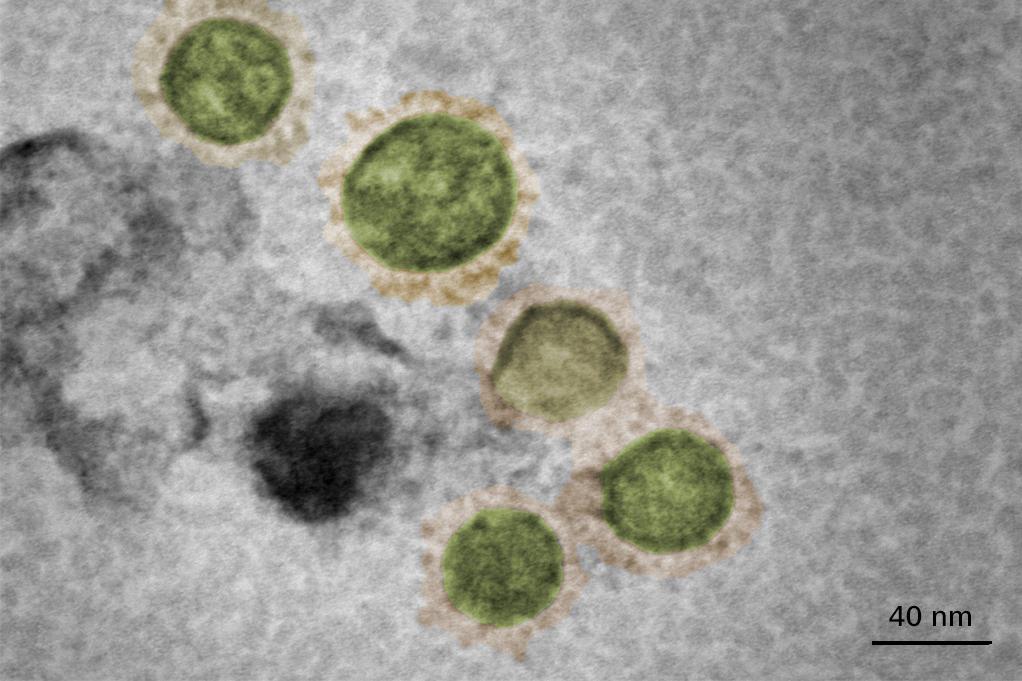 在组织培养物中生长的SARS-CoV-2新冠病毒，经化学固定灭活