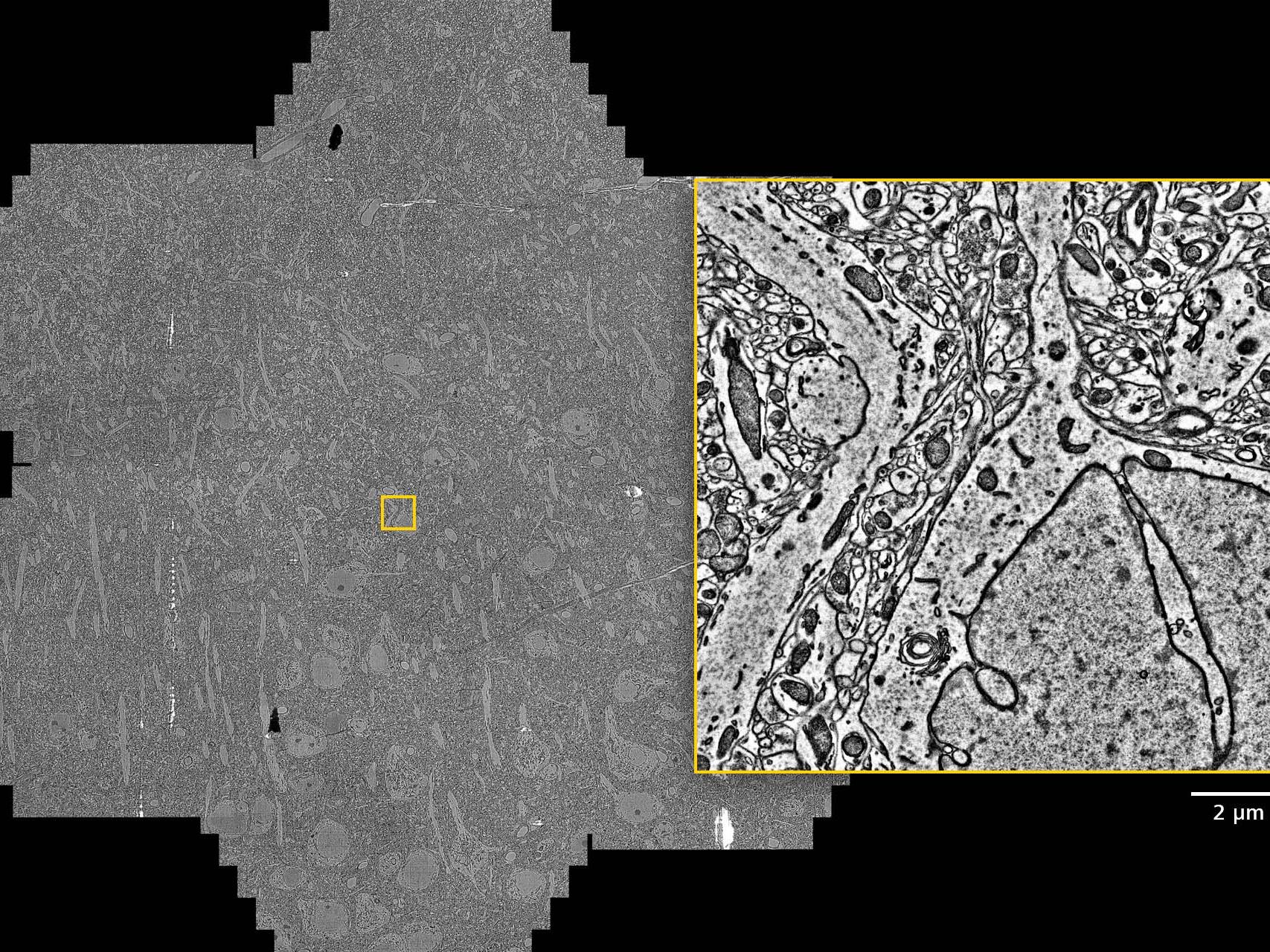 Mouse brain section (50 nm thick), seven hexagonal multi-beam fields of view acquired in less than 20 seconds with a MultiSEM 706 covering an area more than 400 μm in diameter. Sample courtesy of B. Kasthuri, University of Chicago, IL, USA.