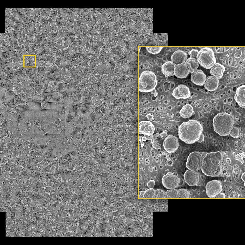 Separatorfolie eines entladenen Akkus mit Ausfällungen, Anodenseite. Bild aufgenommen bei geringer Landeenergie (1 keV) und einer Pixelgröße von 4 nm über ein Sehfeld von 108 μm × 94 μm.