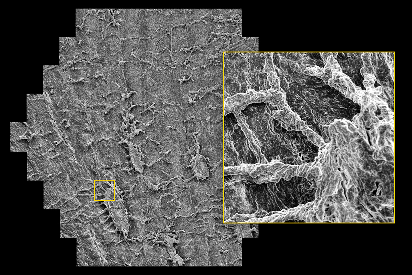 Femoral neck sample, selectively etched to carve out osteocytes, hidden within the bone matrix before. Sample courtesy of M. Knothe Tate, University of New South Wales, Australia, and U. Knothe, Cleveland, OH, USA.