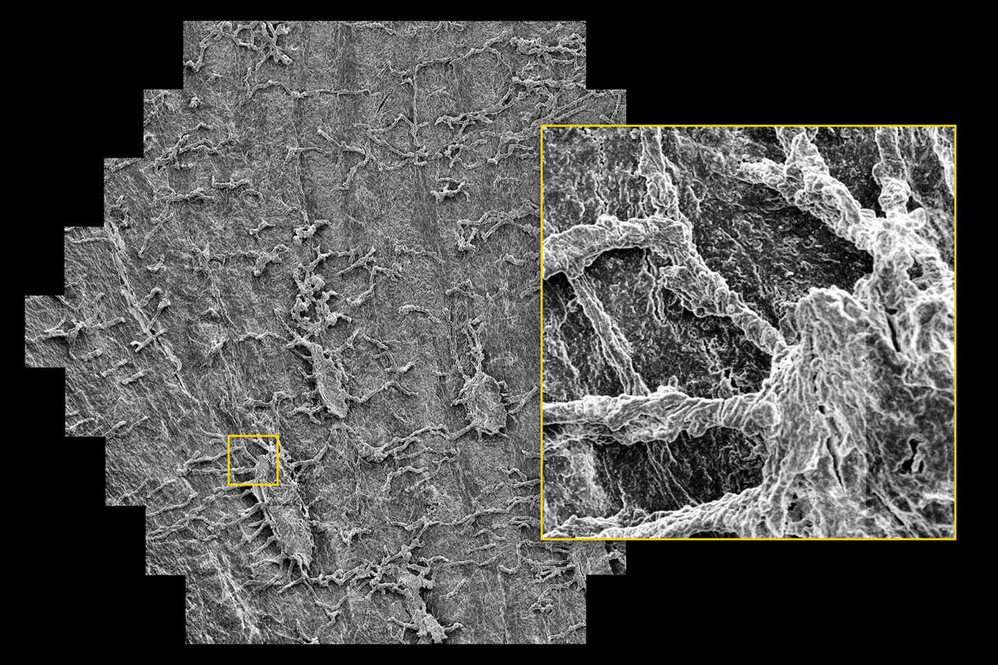 Muestra del cuello femoral, grabada de forma selectiva para esculpir osteocitos, antes escondidos de la matriz ósea antes. Muestra cortesía de M. Knothe Tate, Universidad de Nueva Gales del Sur, Australia, y U. Knothe, Cleveland, OH, EE. UU.