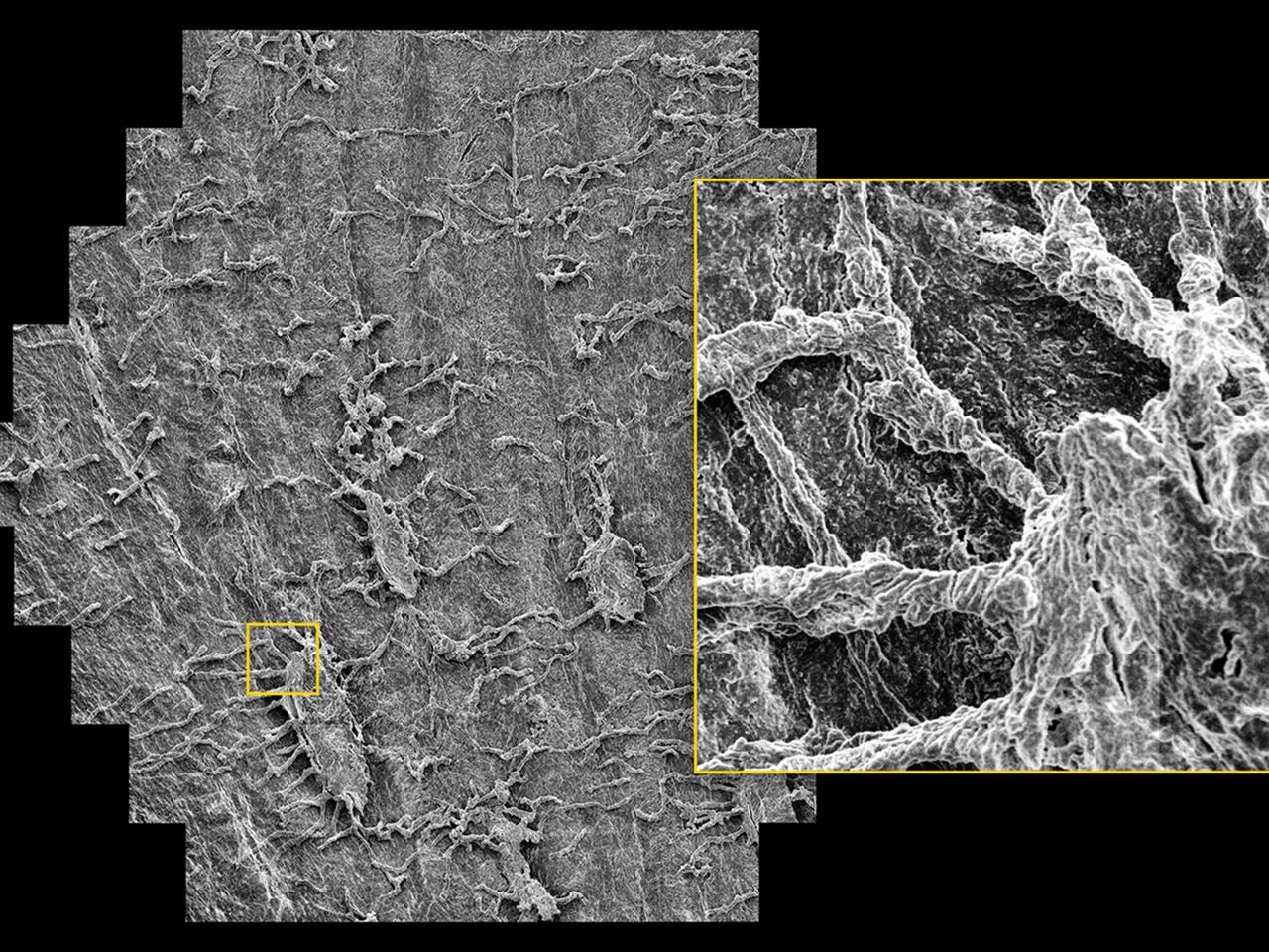 Probe eines Femurhalses, selektiv geätzt für die Darstellung zuvor in der Knochenmatrix versteckter Osteozyten. Probe mit freundlicher Genehmigung von M. Knothe Tate, University of New South Wales, Australien, und Ulf Knothe, Cleveland, Ohio, USA.