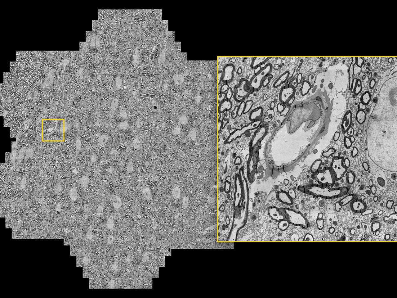 Coupe de cerveau de souris, vitesse d'acquisition maximale de 1,22 gigapixels/seconde. Avec l'aimable autorisation de J. Lichtman, Université de Harvard, Cambridge, MA, États-Unis.