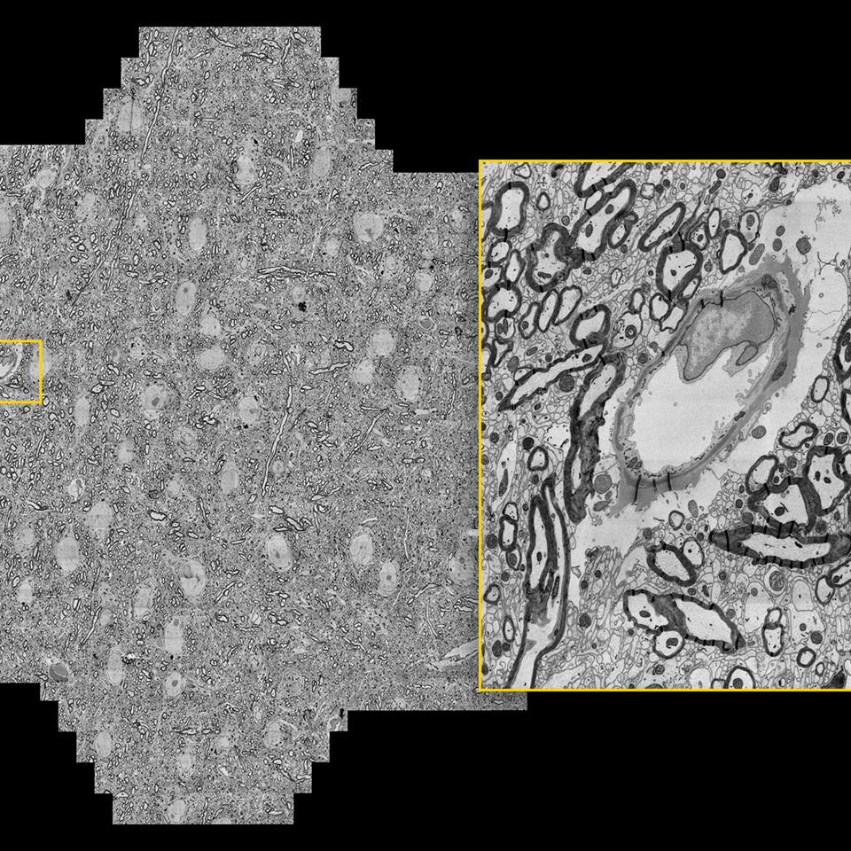 Coupe de cerveau de souris, vitesse d'acquisition maximale de 1,22 gigapixels/seconde. Avec l'aimable autorisation de J. Lichtman, Université de Harvard, Cambridge, MA, États-Unis.