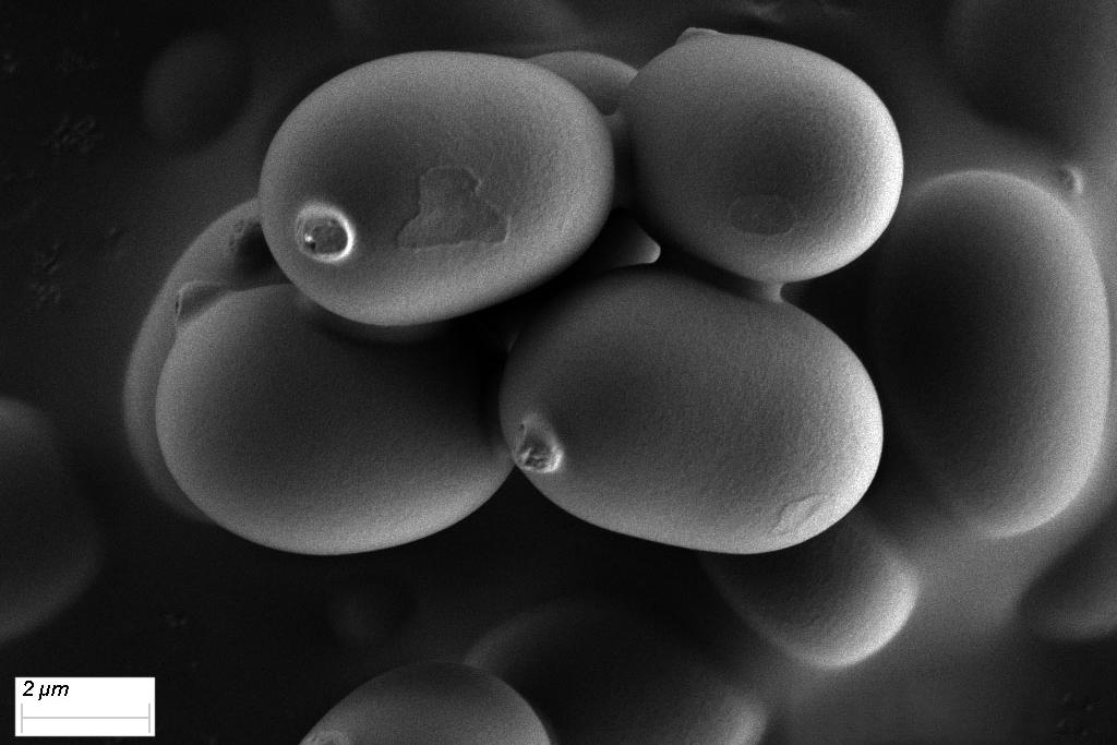 Image de spores de champignon capturée à 1 kV sous vide poussé. Le Sigma 500 permet de capturer aisément les images de ces structures fragiles et délicates à basse tension.