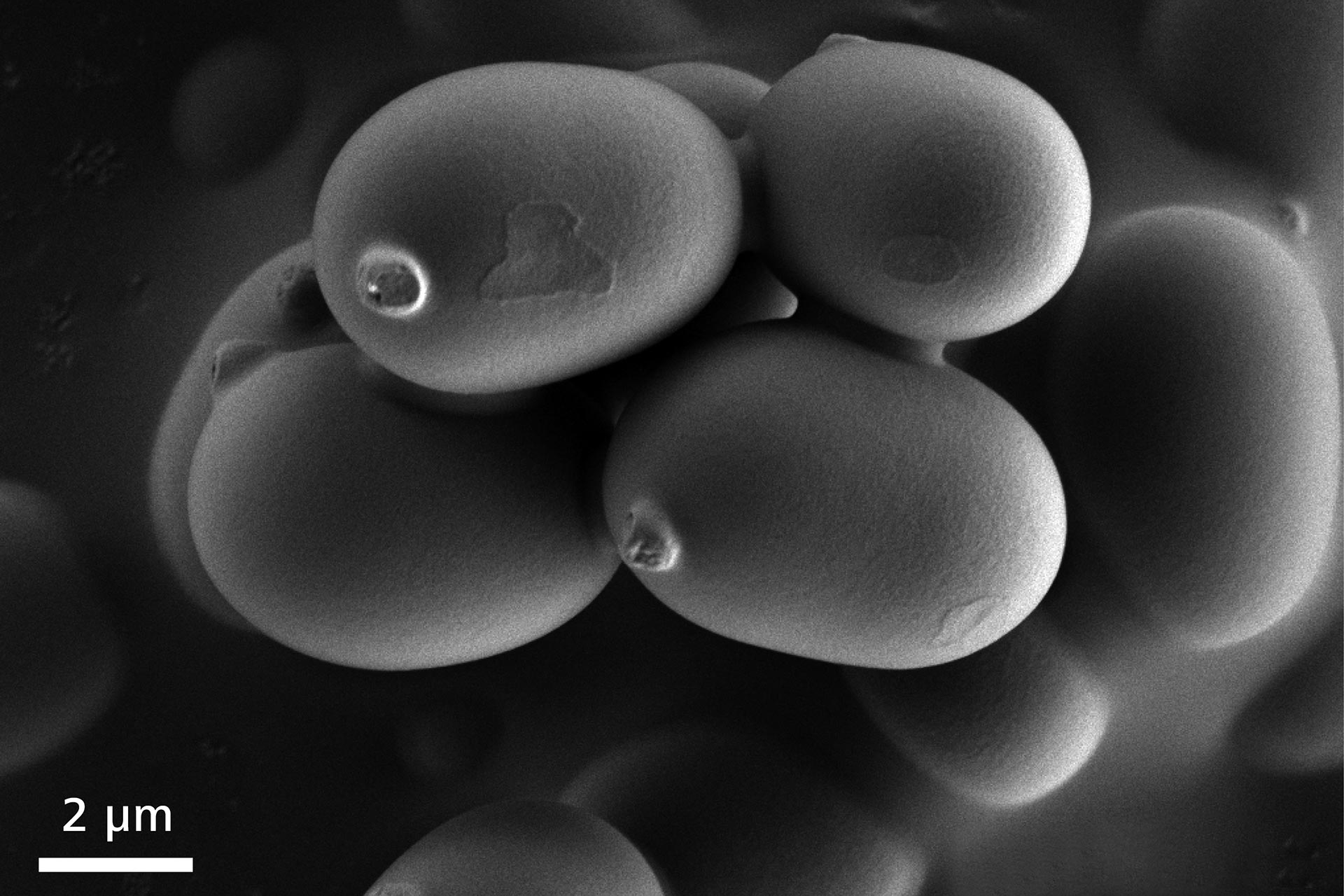 Image de spores de champignon capturée à 1 kV sous vide poussé. Sigma 500 capture aisément les images de ces structures fragiles et délicates à basse tension.
