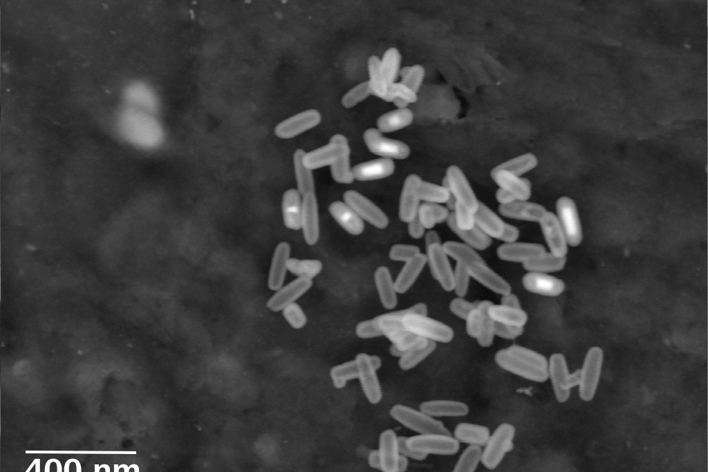 MSC capsules (hollow mesoporous silica) for drug delivery. 