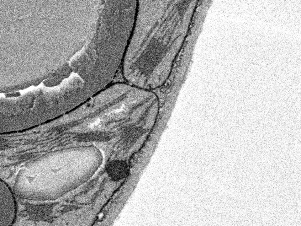 Arabidopsis thaliana capturée sans Focal CC à gauche et avec Focal CC (à droite). Sans Focal CC, l'image est détériorée par les effets de charge. Avec l'aimable autorisation du Prof S. C. Zeeman, ETH, Zurich, Suisse. 