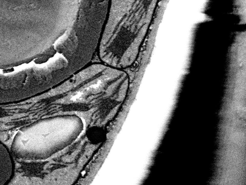 Imagen de Arabidopsis thaliana captada sin CC focal (izquierda) y con CC focal (derecha). Sin CC focal, la imagen está deteriorada por los efectos de carga. Muestra cortesía del Prof. S. C. Zeeman, ETH Zúrich, Suiza. 