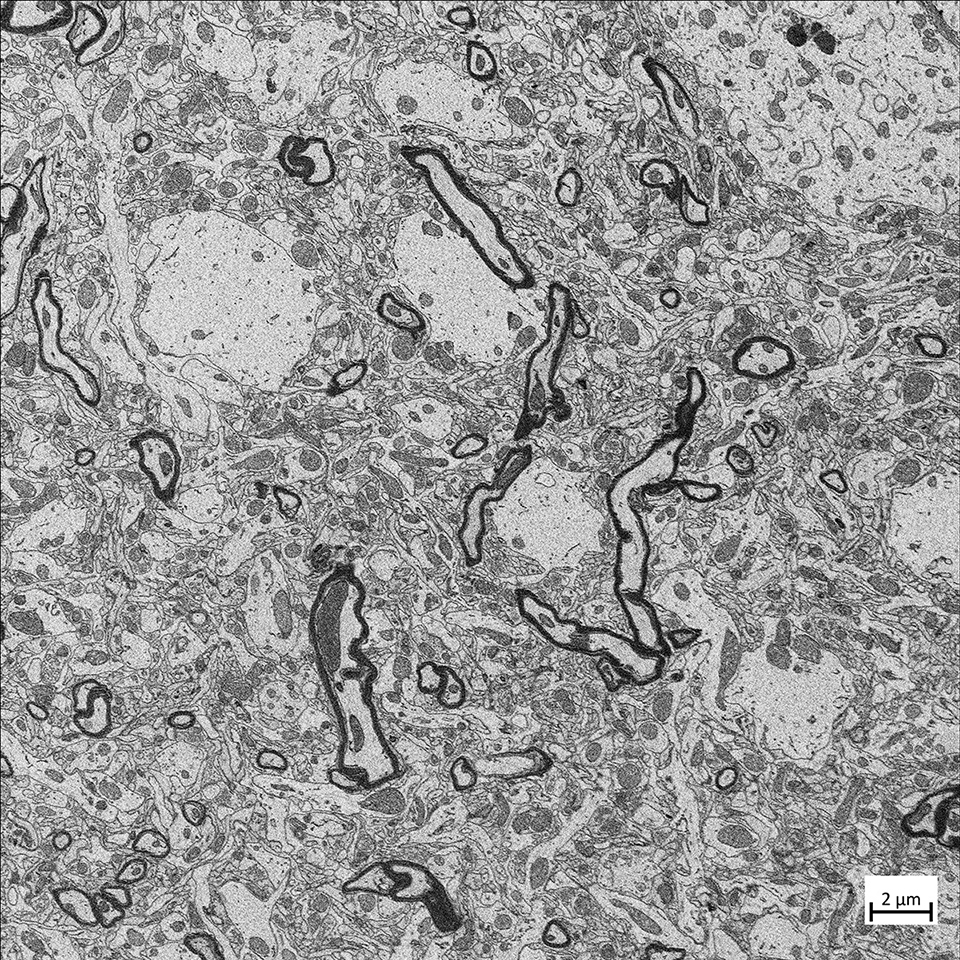 Gewebe eines Mäusehirns, aufgenommen mit ZEISS Volutome und ZEISS GeminiSEM; Pixelgröße: 3 nm. Probe mit freundlicher Genehmigung von Christel Genoud, Université de Lausanne, Schweiz