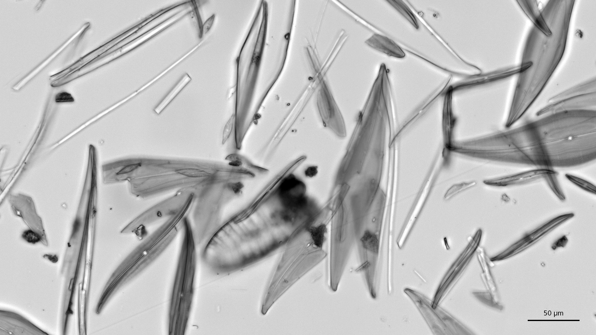 宽角斜纹藻（Pleurosigma angulatum） – 硅藻，20× Plan-Apochromat 0.8；左：明场，右：TIE浮雕