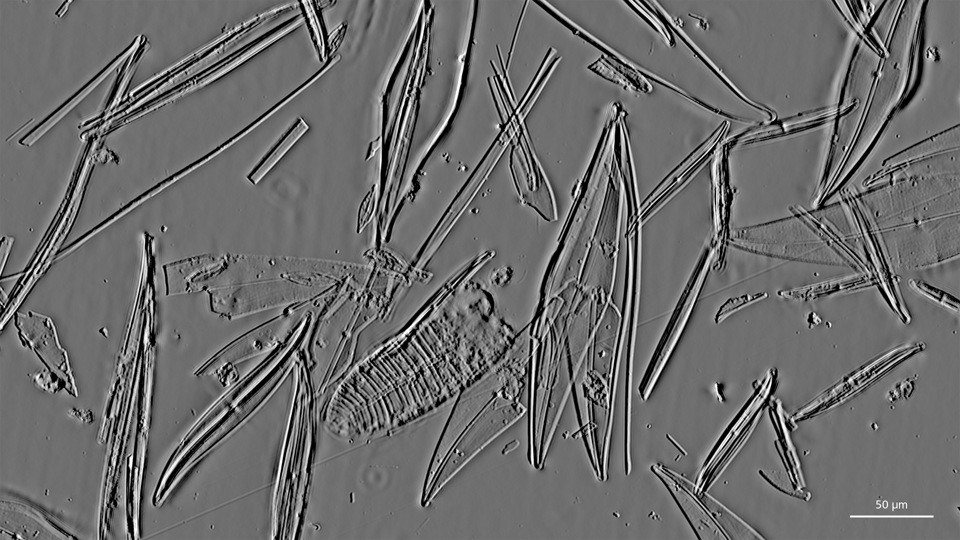 宽角斜纹藻（Pleurosigma angulatum） – 硅藻，20× Plan-Apochromat 0.8；左：明场，右：TIE浮雕