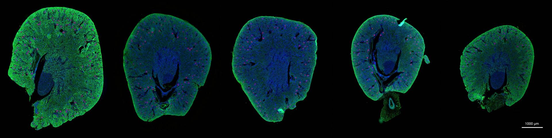 健康な野生型動物からのパラフィン包埋マウス腎臓（12週間）。Cy3で染色されたネフリン。対比染色としてのPCNAAPC（FarRed）およびDAPI。20x NA 0.8対物レンズでイメージング。