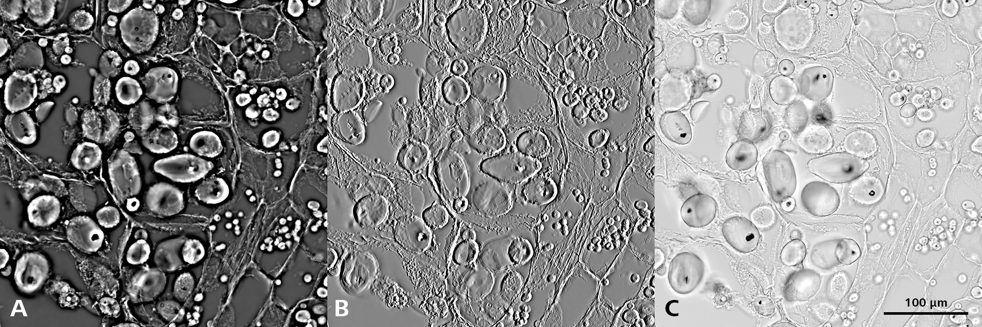 Solanum tuberosum（ジャガイモ） – ジャガイモ澱粉、20x Plan-Apochromat 0.8、A) TIE位相差、B) TIEレリーフコントラスト、C) 明視野