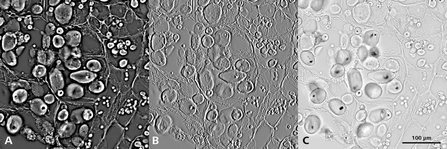Solanum tuberosum – amido de batata, 20x Plan-Apochromat 0.8; A) Contraste de fase TIE, B) Contraste de relevo TIE, C) Campo claro