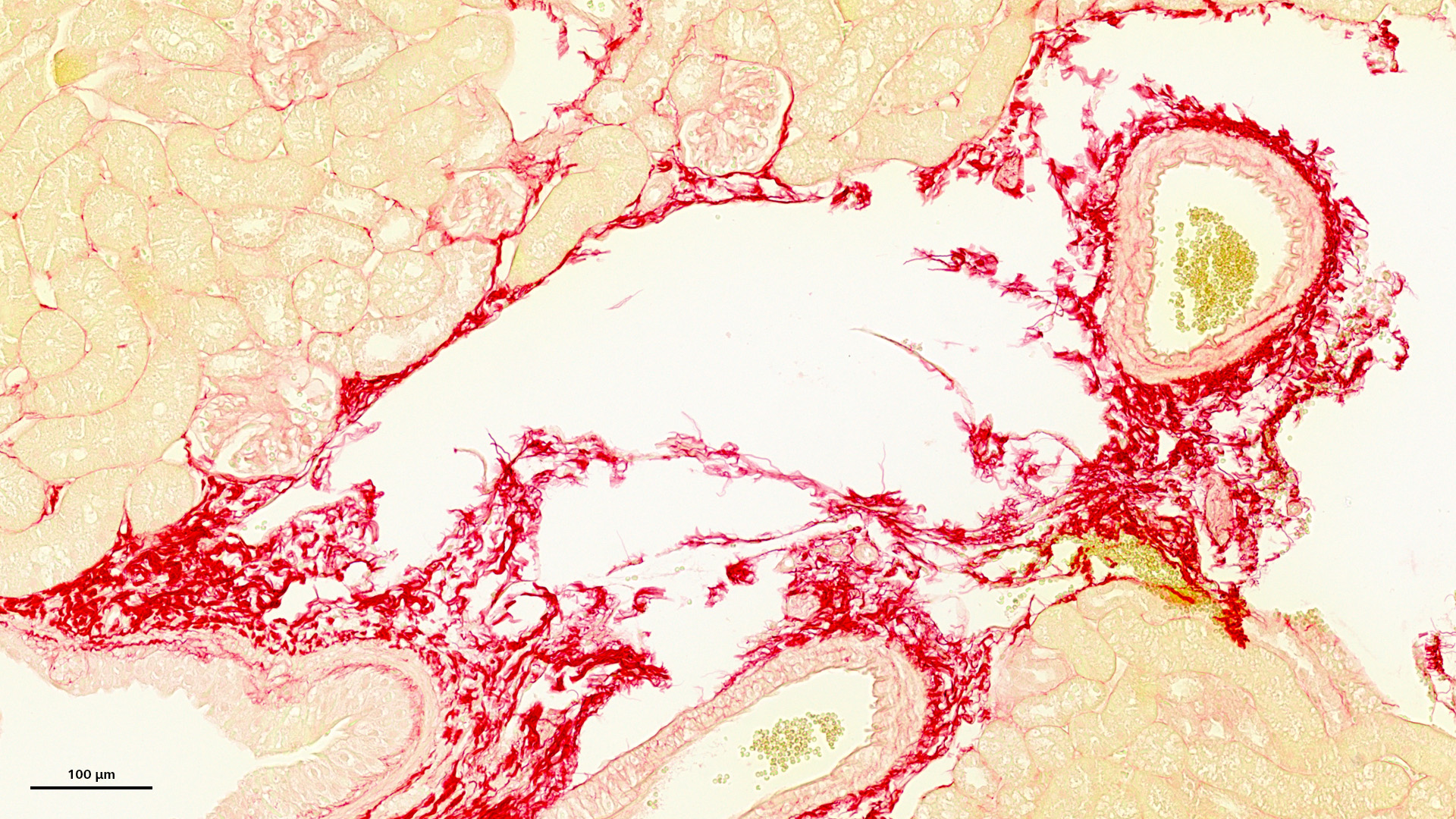 Mouse kidney wound healing assay, stained with sirius red, brightfield. Sample courtesy: Alexander Lomow, Evotec