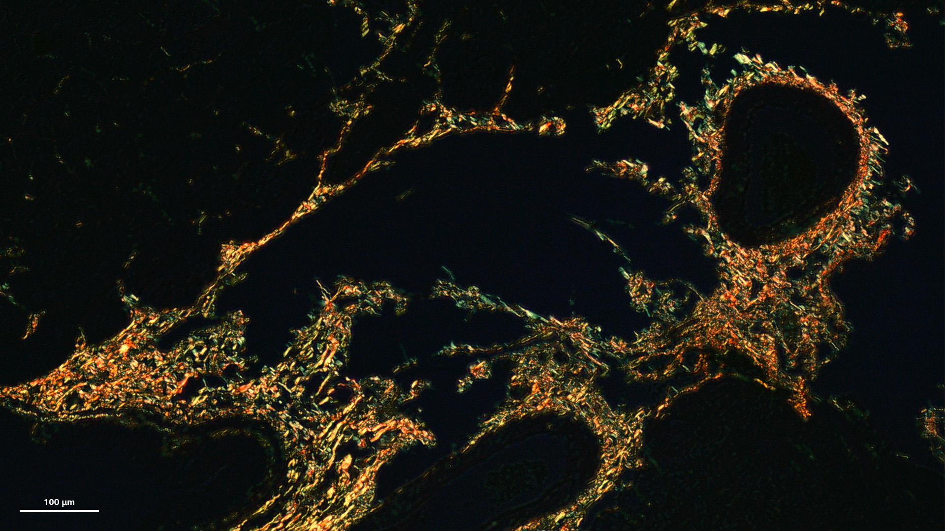 Essai de cicatrisation d'un rein de souris, coloration au rouge sirius, polarisation translinéaire. Avec l'aimable autorisation de : d'Alexander Lomow, Evotec