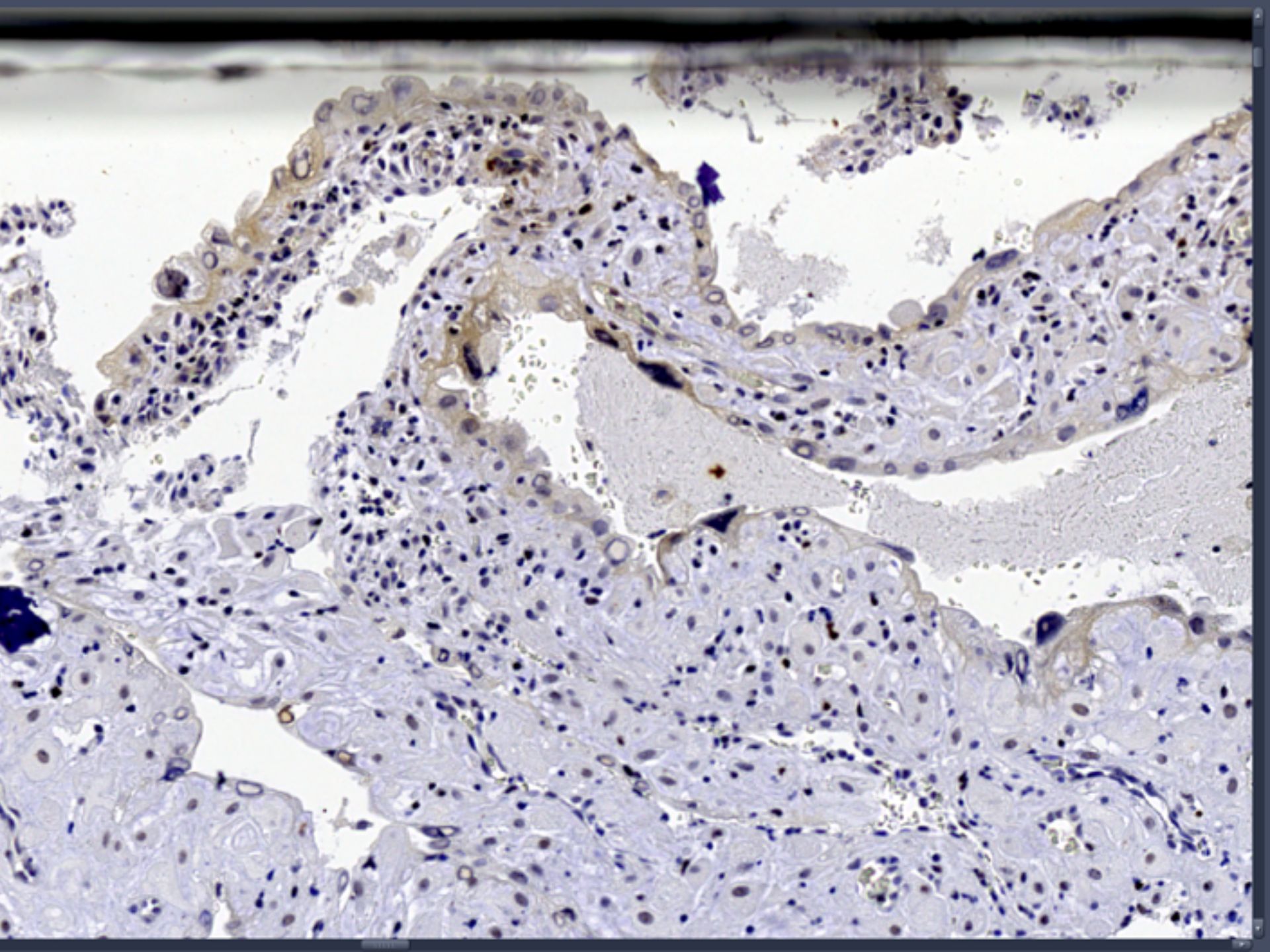 WSI of tissue.