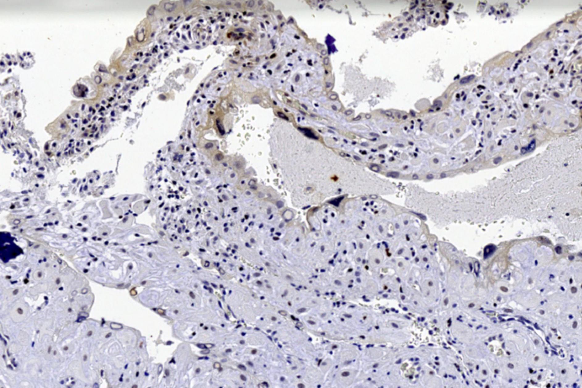 WSI of tissue.