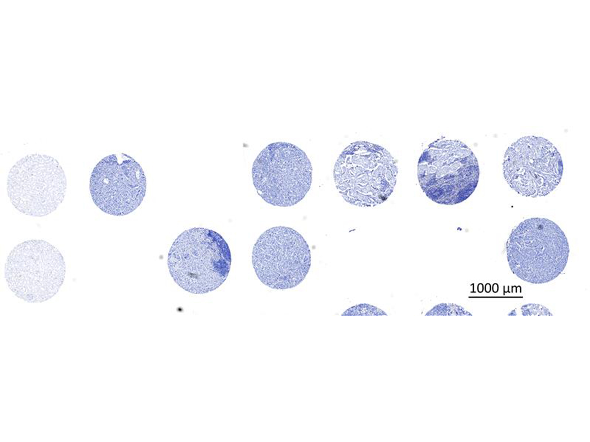 Tissue microarray