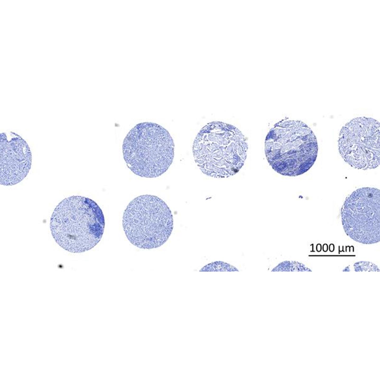 Tissue microarray