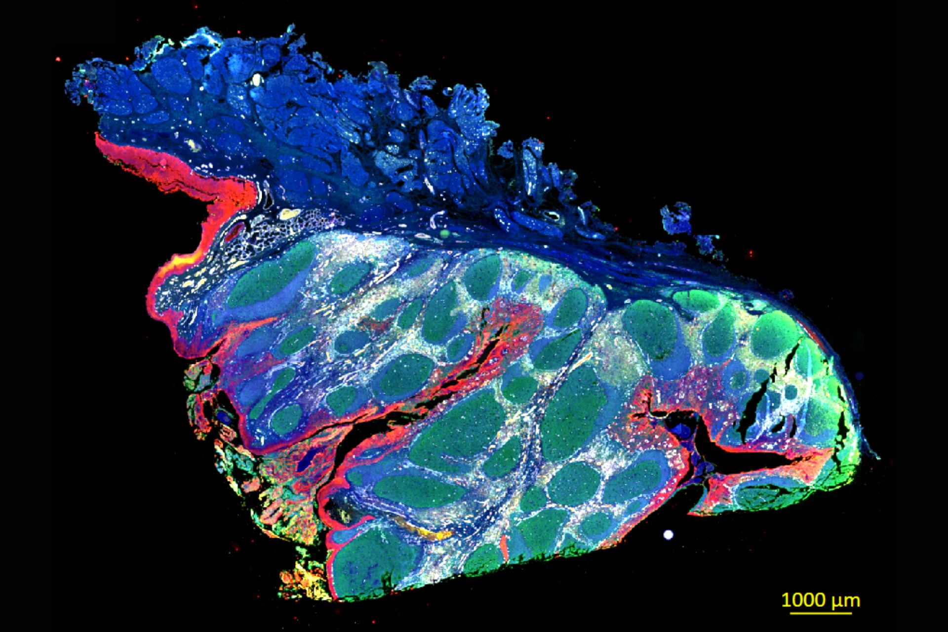 Human tonsils in fluorescence contrast, Opal Polaris 7-color automation IHC kit