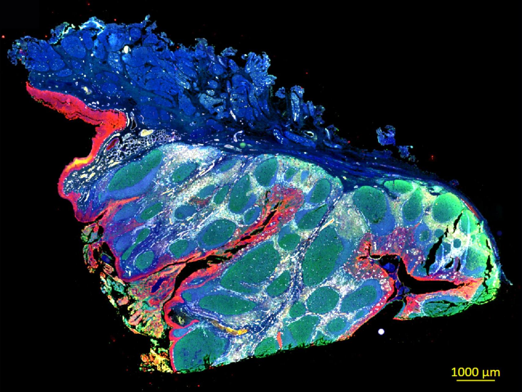 Human tonsils in fluorescence contrast, Opal Polaris 7-color automation IHC kit