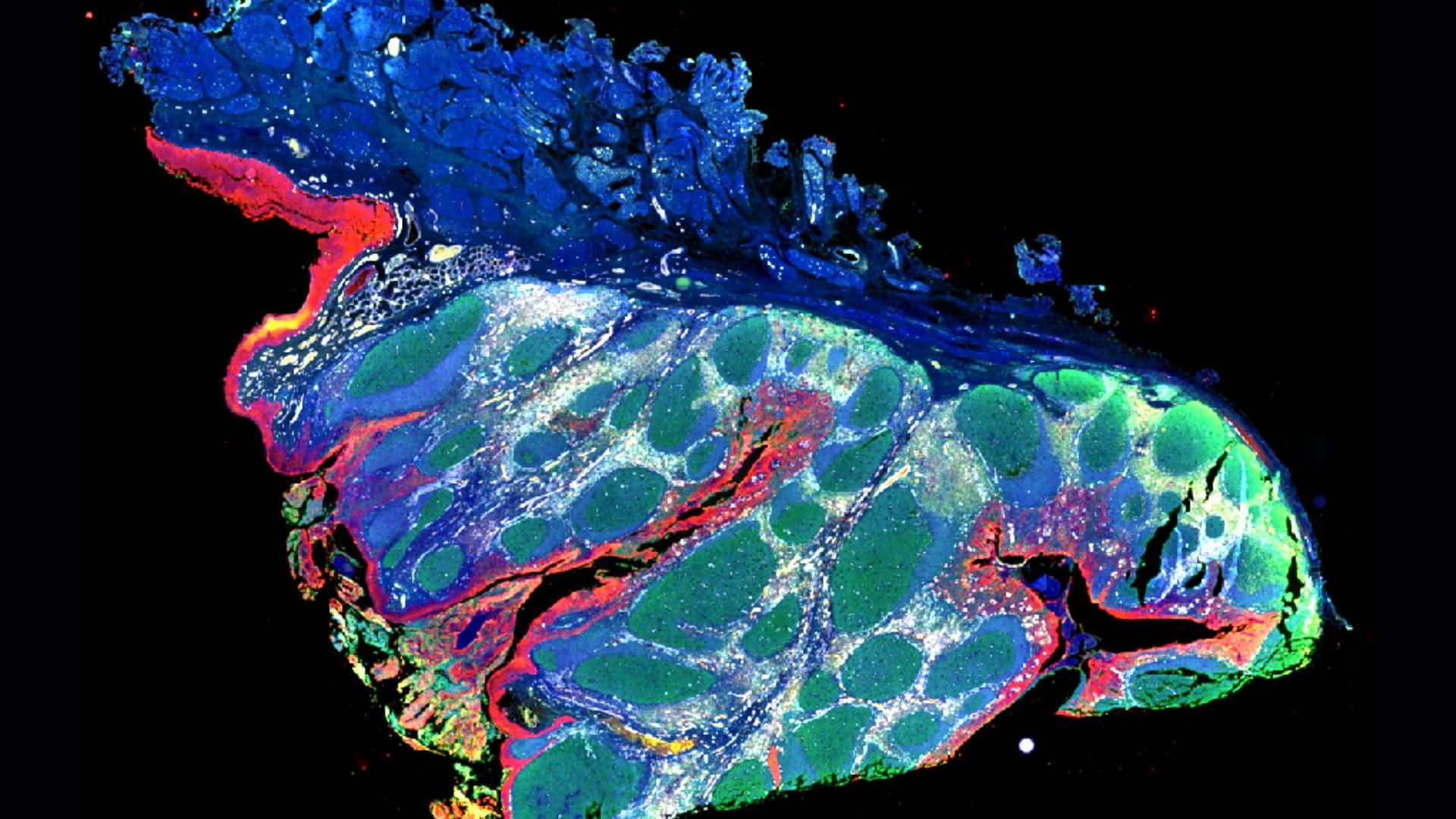 Human tonsils in fluorescence contrast, Opal Polaris 7-color automation IHC kit