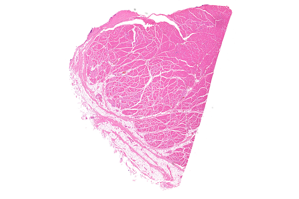 Tissue section, H&E staining