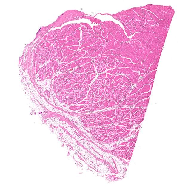 Tissue section, H&E staining