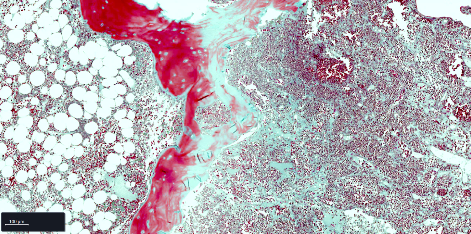 Bone Marrow FFPE tissue section stained with Goldner staining.