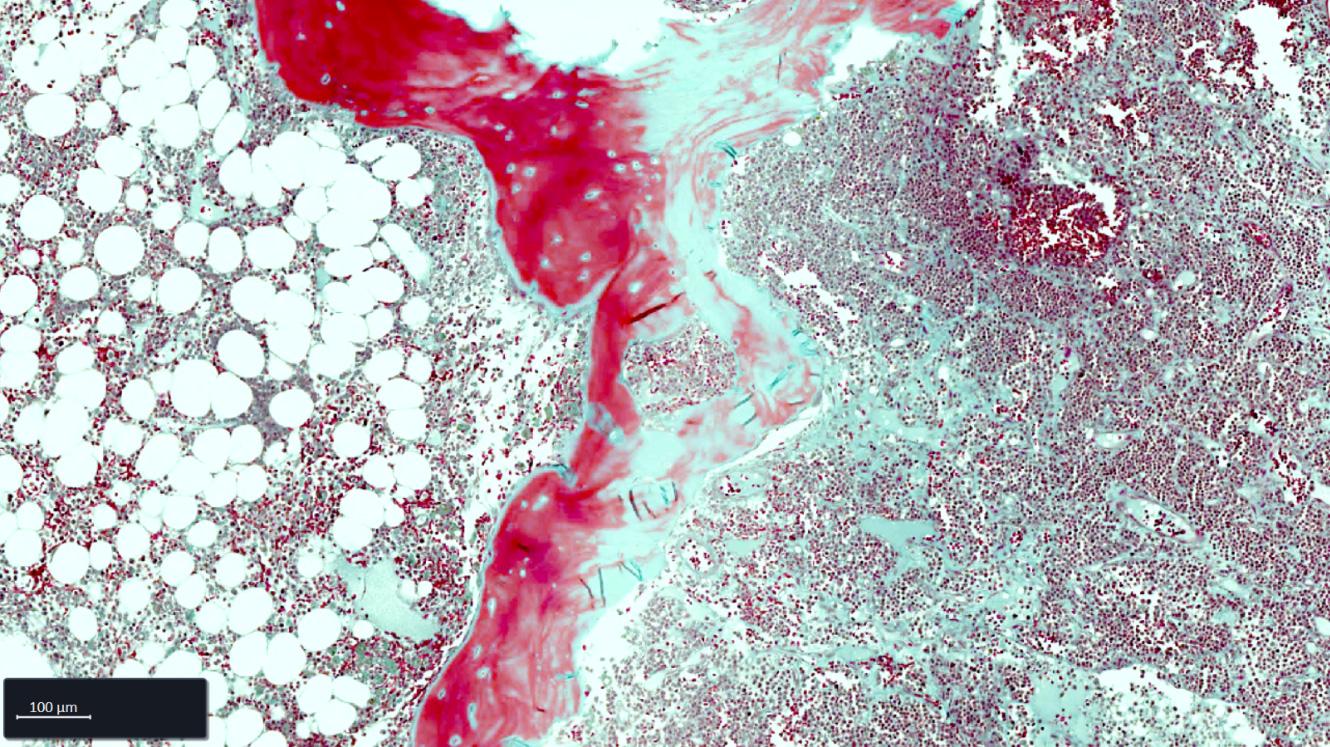 Bone Marrow FFPE tissue section stained with Goldner staining.