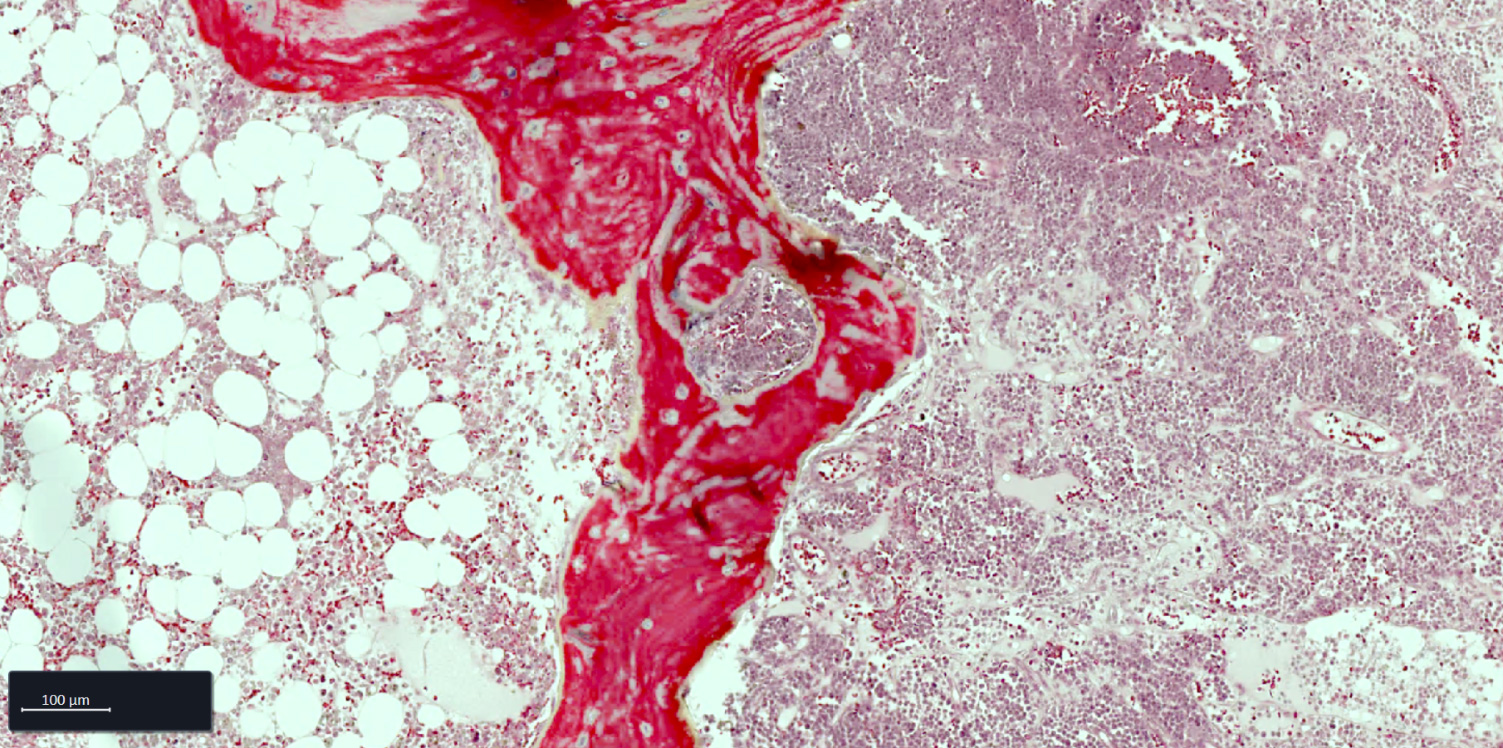 Bone Marrow FFPE tissue section stained with movat staining